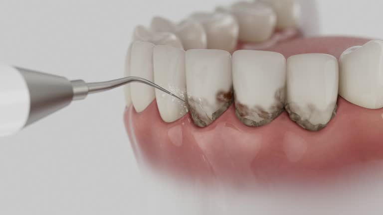 Trusted Tooth Extraction service in Dimondale, MI - Dentist Open Now
